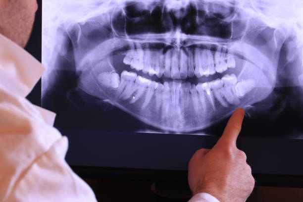 Best Emergency Root Canal Treatment in Kearney, MO