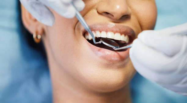 Best Emergency Dentist for Special Needs Patients in Kearney, MO